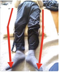 施術前の写真