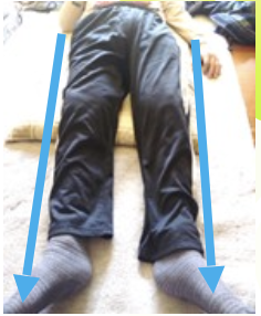 施術後の写真