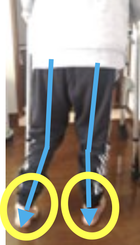施術前の写真