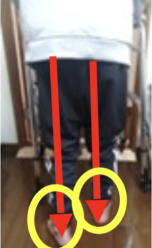 施術後の写真