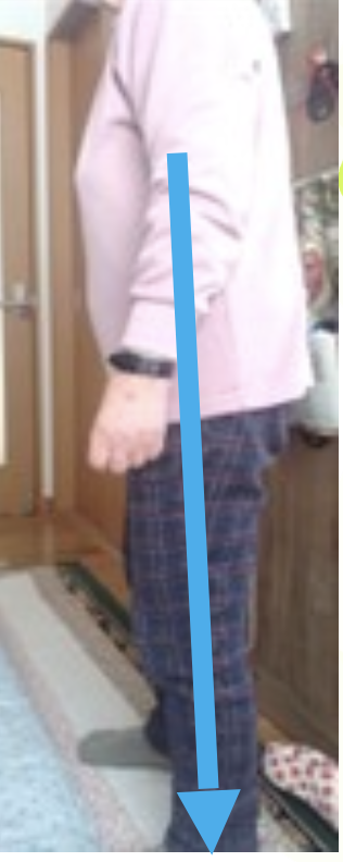 施術後の写真